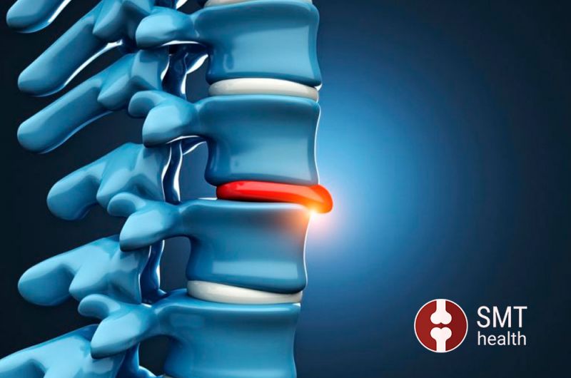 Грыжа межпозвоночного диска
